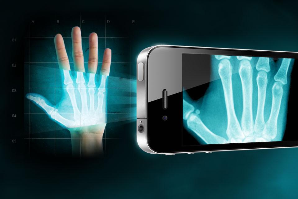 the-future-is-closer-with-x-ray-for-phones